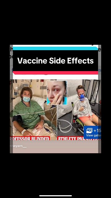 Vaccine Side Effects
