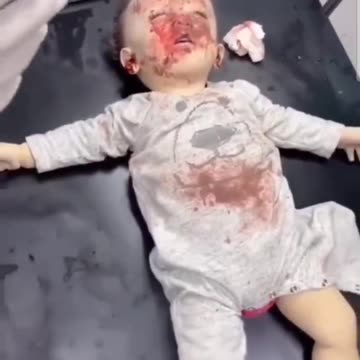 How can the USA stand by and not condemn Israel