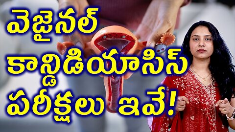 వెజైనల్ కాన్డిడియాసిస్ పరీక్షలు ఇవే Tests and Investigations for Vaginal Candidiasis Homeopathy
