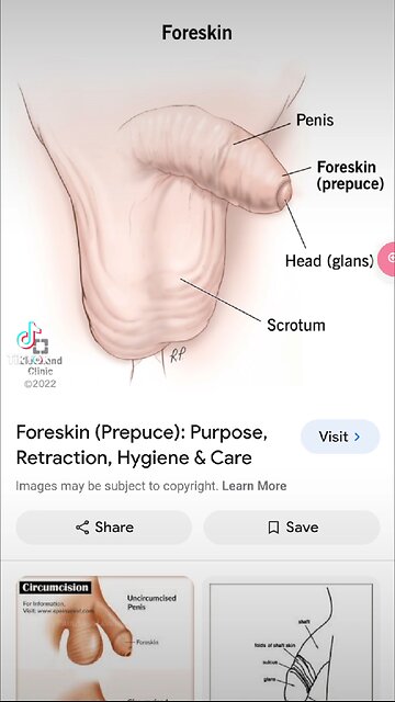 Normal functioning part