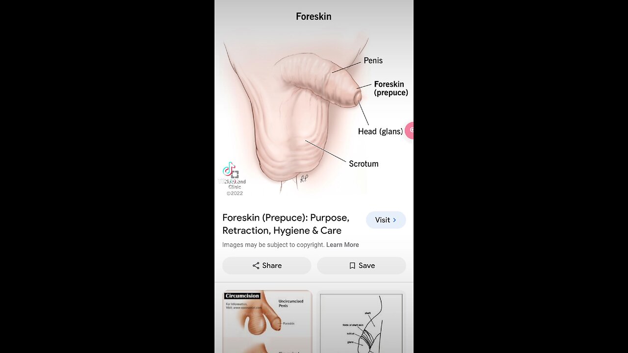 Normal functioning part