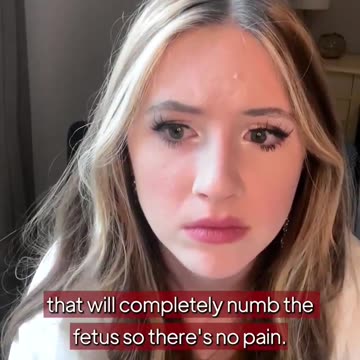 34 Week abortion - Maryland - Very Common