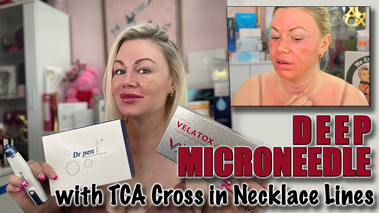 Deep Microneedle with Velatox & TCA Cross for the Necklace Lines, Code Jessica10 Saves you Money