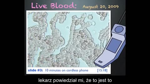 How does the RADIATION from SMARTphone affect the human body? (Clumps blood cells together!)