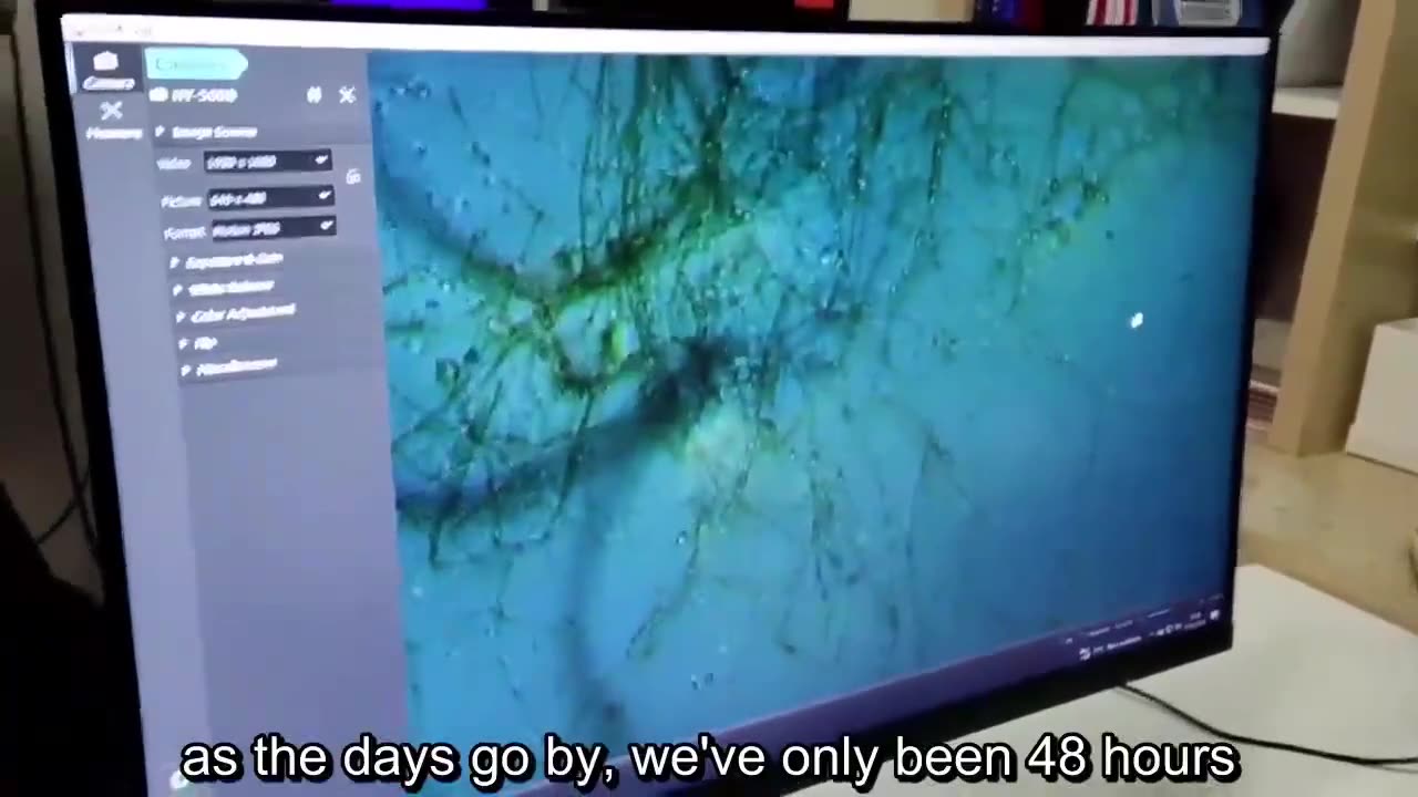 This is what Forms inside the Bodies Of | Those Who have been Inoculated with Covid Vaccines