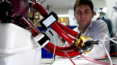 Australian becomes first man discharged with artificial heart