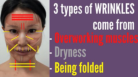 3 types of facial wrinkles