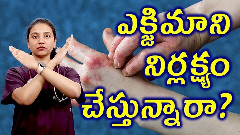 ఎక్జిమా ని నిర్లక్ష్యం చేస్తున్నారా? What Happens if You Neglect Eczema? Treatment | హోమియోపతి