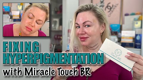 Fixing Hyperpigmentation with Miracle Touch Br, Acecosm.com, code Jessica10 saves you money