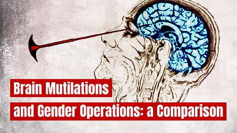 Biggest Medical Crime in the US: Lobotomy vs. Gender Surgery