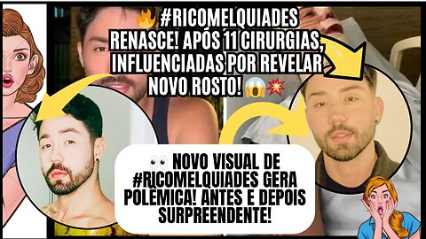 🔥Nossa! veja isso! #RicoMelquiades RENASCE! Após 11 cirurgias, influenciadas por revelar novo rosto!