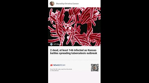 Wyandotte County 2 dead, at least 146 infected as Kansas battles spreading tuberculosis outbreak