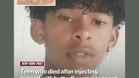 a boy inject 💉 butterfly 🦋 DNA into his legs 🦵 but died over allergic reactions 02/22/25