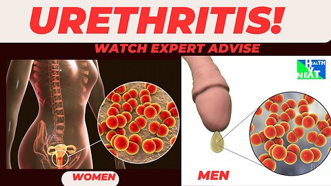 Common urinary problems, Urethritis_Expert advice and treatment options.