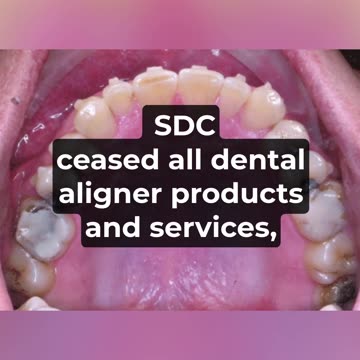 SmileDirectClub settlement