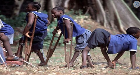 Polio Vaccine Fraud-DDT Poison Causes Polio?