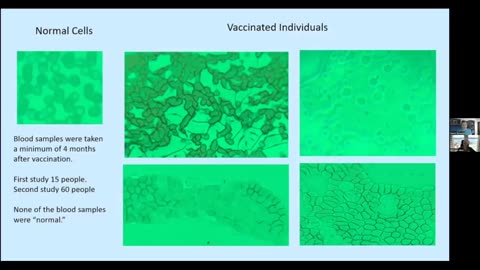 Vax & shedding side effects & what you can naturally do to reverse it! Michael Jaco & David Schmidt!