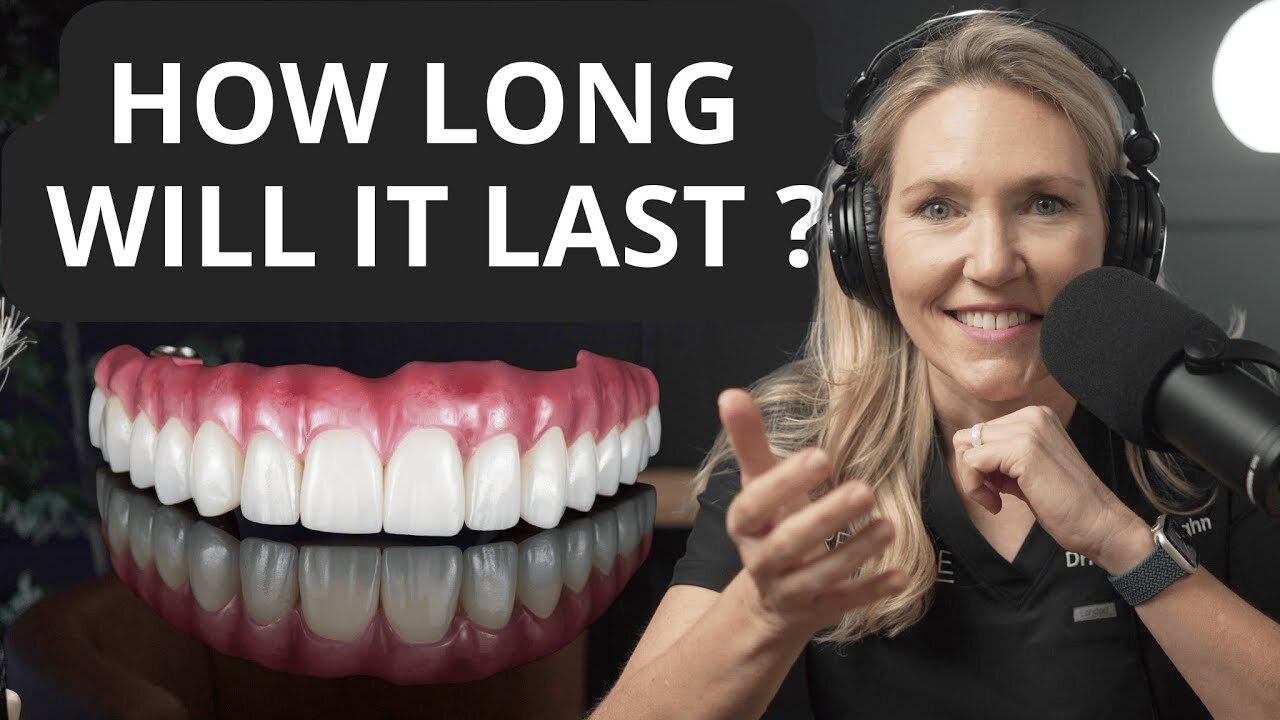 The Future Of All-on-4 Dental Implants: A Look At Longevity
