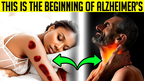 7 EARLY SIGNS of ALZHEIMER’S DISEASE that you SHOULD NEVER IGNORE!