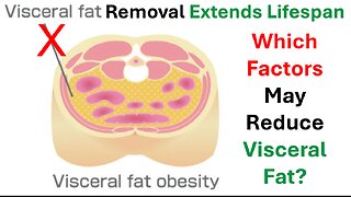 Visceral Fat Removal Extends Lifespan: Which Factors May Reduce Visceral Fat?