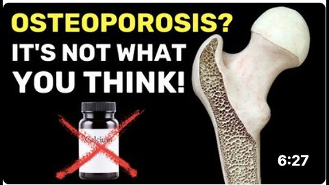 The Hidden Cause of Osteoporosis (It's Not Calcium Deficiency!)