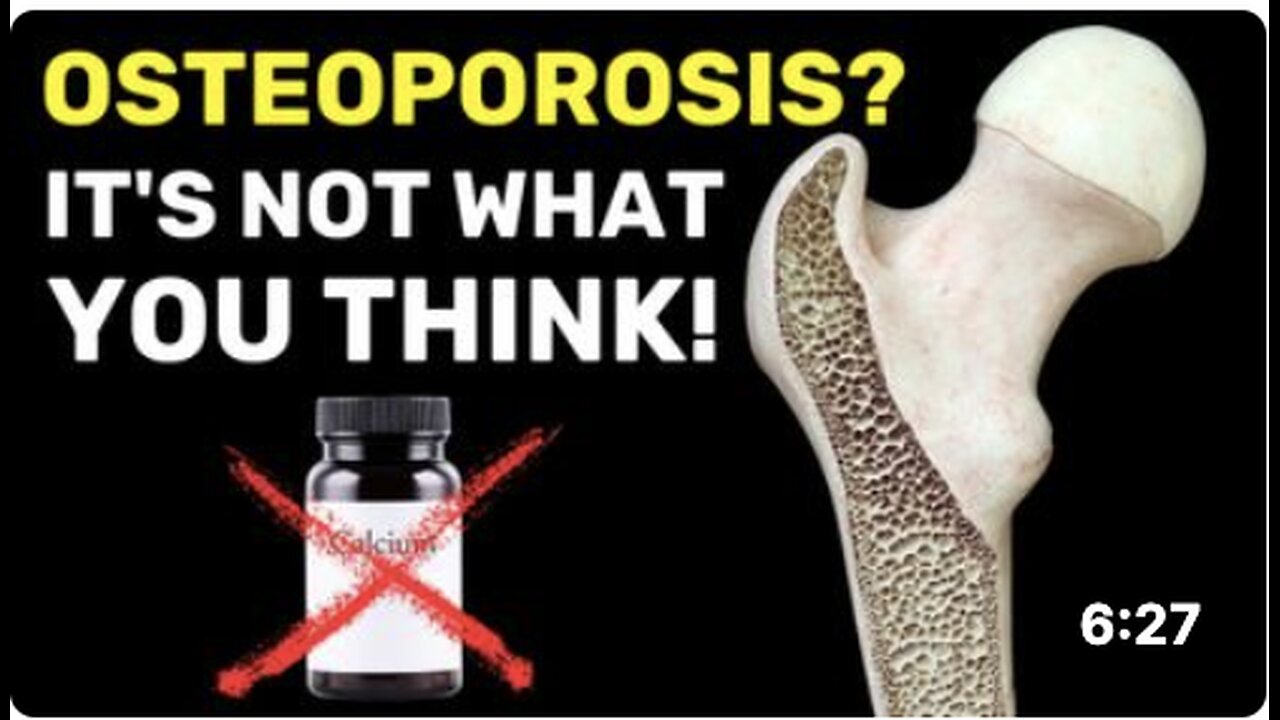 The Hidden Cause of Osteoporosis (It's Not Calcium Deficiency!)