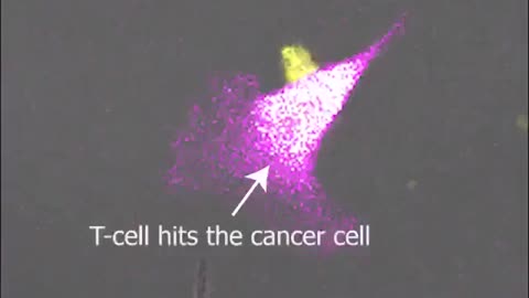 CAR T-Cell Therapy