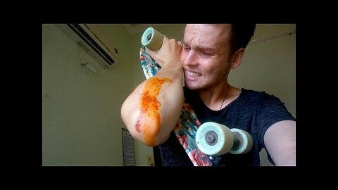 BAD SKATEBOARD FALL - VIETNAM TRAVEL