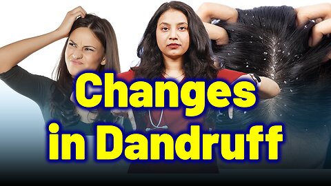 Changes in Dandruff, Seborrheic Dermatitis, Psoriasis.| Treatment & Cure | Homeopathy, Medicine