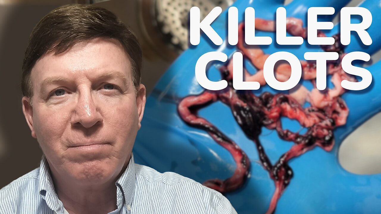 The Emergence of Deadly White Blood Clots after Covid - Tom Haviland Shares his Insights