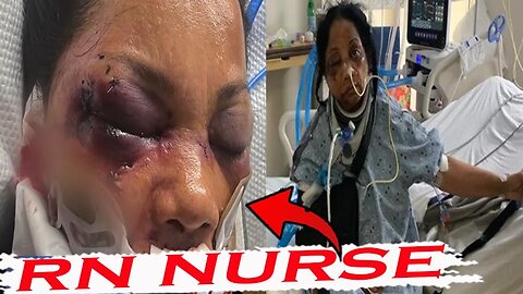 RN Nurse Gets Brutally Beating, Angie Stone dies at 63, Synthetic Braiding Hair Danger