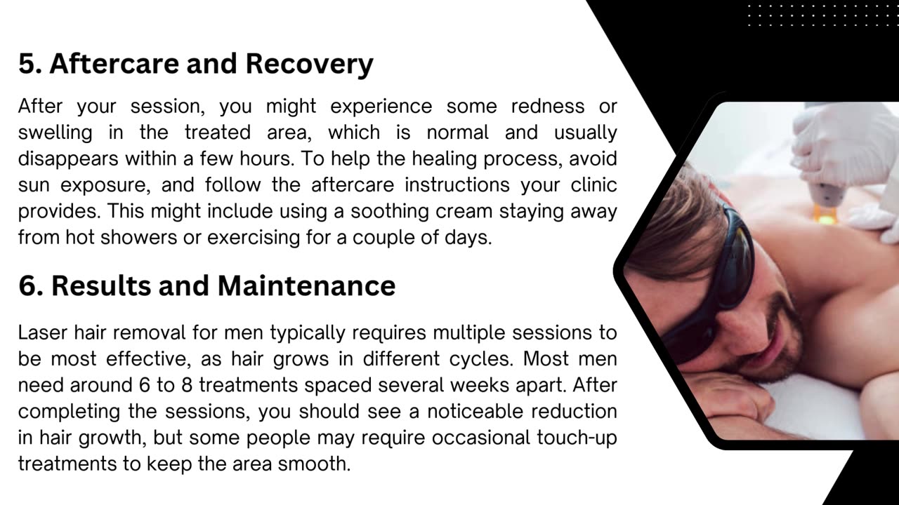 What Every Man Should Know Before Getting Laser Hair Removal
