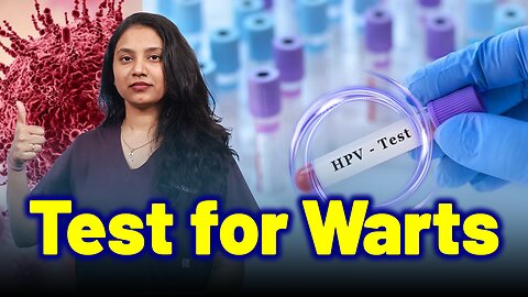 Mandatory Test for Warts | Treatment Cure Relief Medicine | Skin Hair Nail | Homeopathy