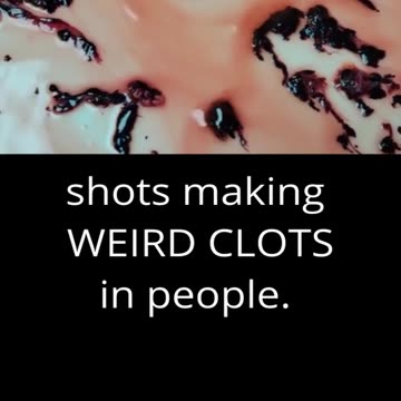 covid vaxx creating CLOTHS in peoples VEINS