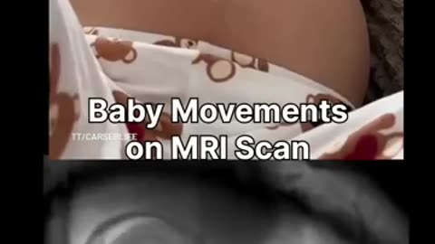Unborn Foetus regularly practices kicks in mother's little wombs..