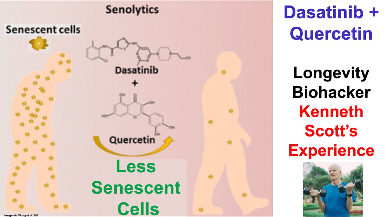 Dasatinib + Quercetin: Longevity Biohacker Kenneth Scott's Experience