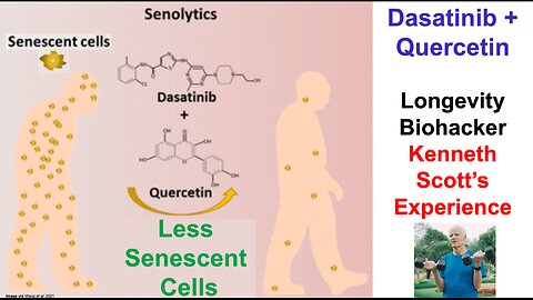 Dasatinib + Quercetin: Longevity Biohacker Kenneth Scott's Experience