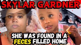 There Were 2 Kinds of Bite Marks Were Found on Her Body!- The Story of Skylar Gardner