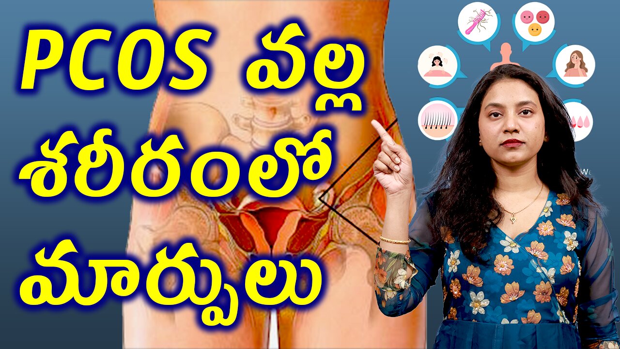 PCOS వల్ల శరీరం లో మార్పులు Changes in the Body Due to PCOS PCOD Treatment Cure | హోమియోపతి