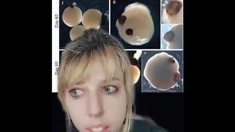 ORGANOID INTELLIGENCE BIOPROCESSORS