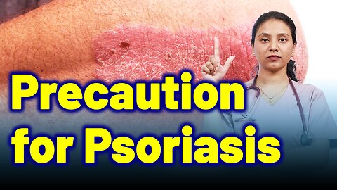 Precautions for Psoriasis | Treatment and Cure | Homeopathy, Medicine & Surgery