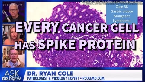 Every Cancer Cell has Spike Protein.