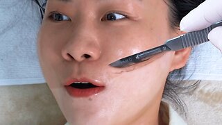 ASMR ¦ Women Face Shaving ¦ Dermaplaning Treatment