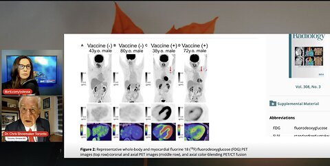 Short Clips Version-100% Of Vaxxed Hearts Extremely Damaged As Per Pet/CT Scans.