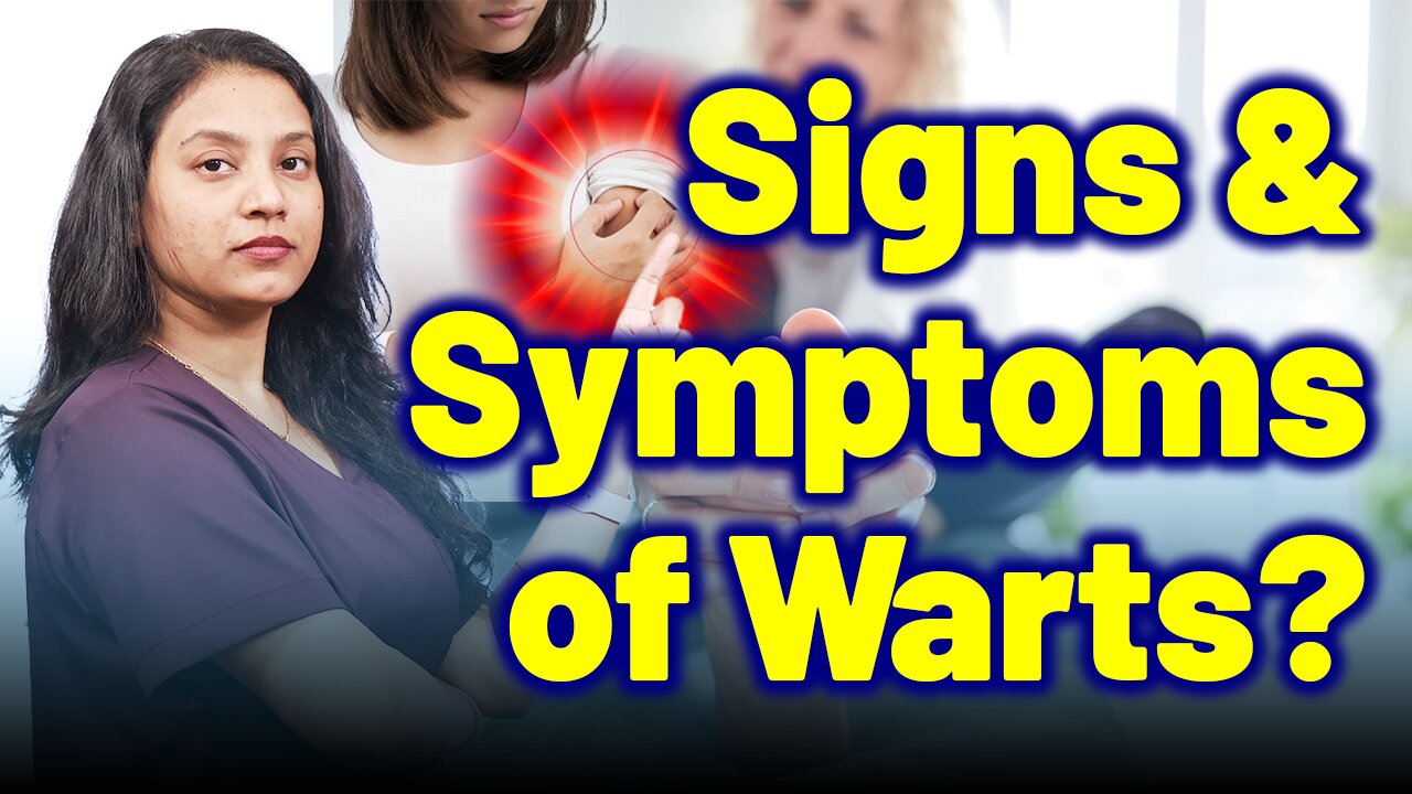 Symtoms and Signs of Warts | Treatment Cure Relief Medicine | Skin Hair Nail | Homeopathy