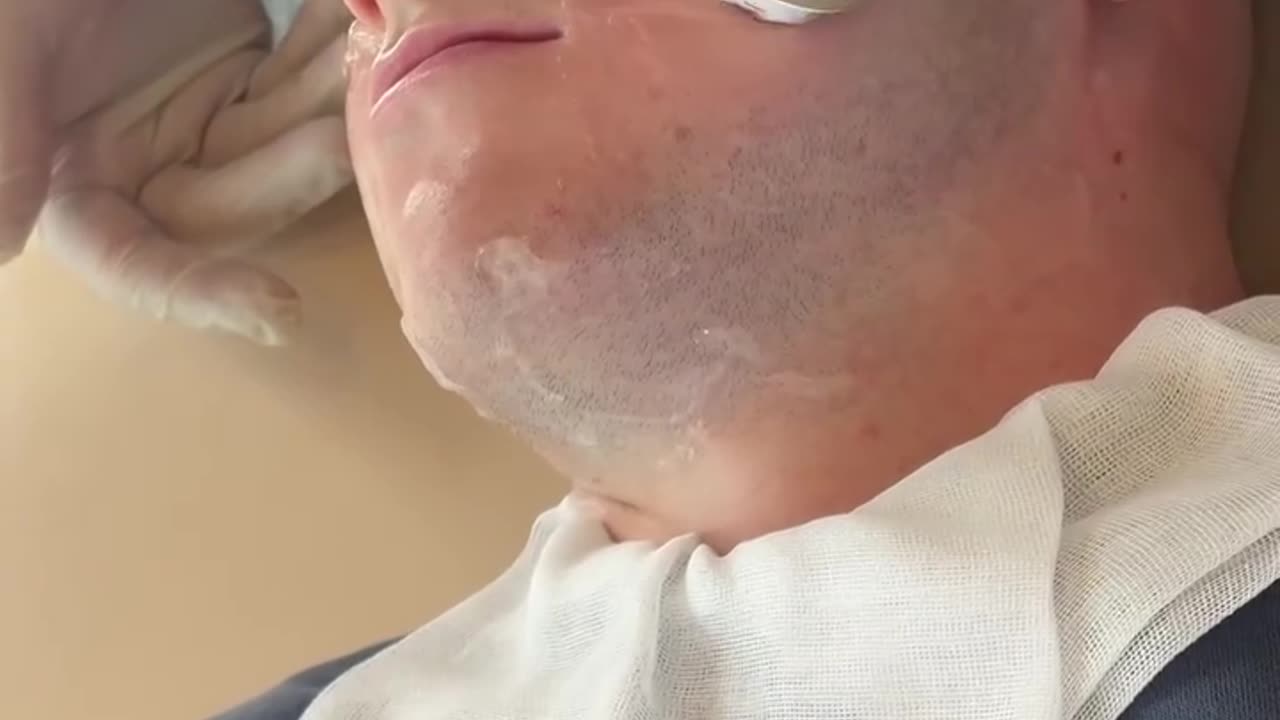 Facials