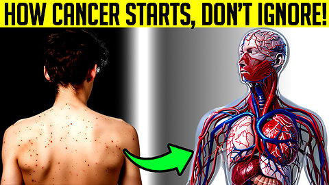 10 Common Signs of CANCER You MUST Watch Before It’s Too Late!