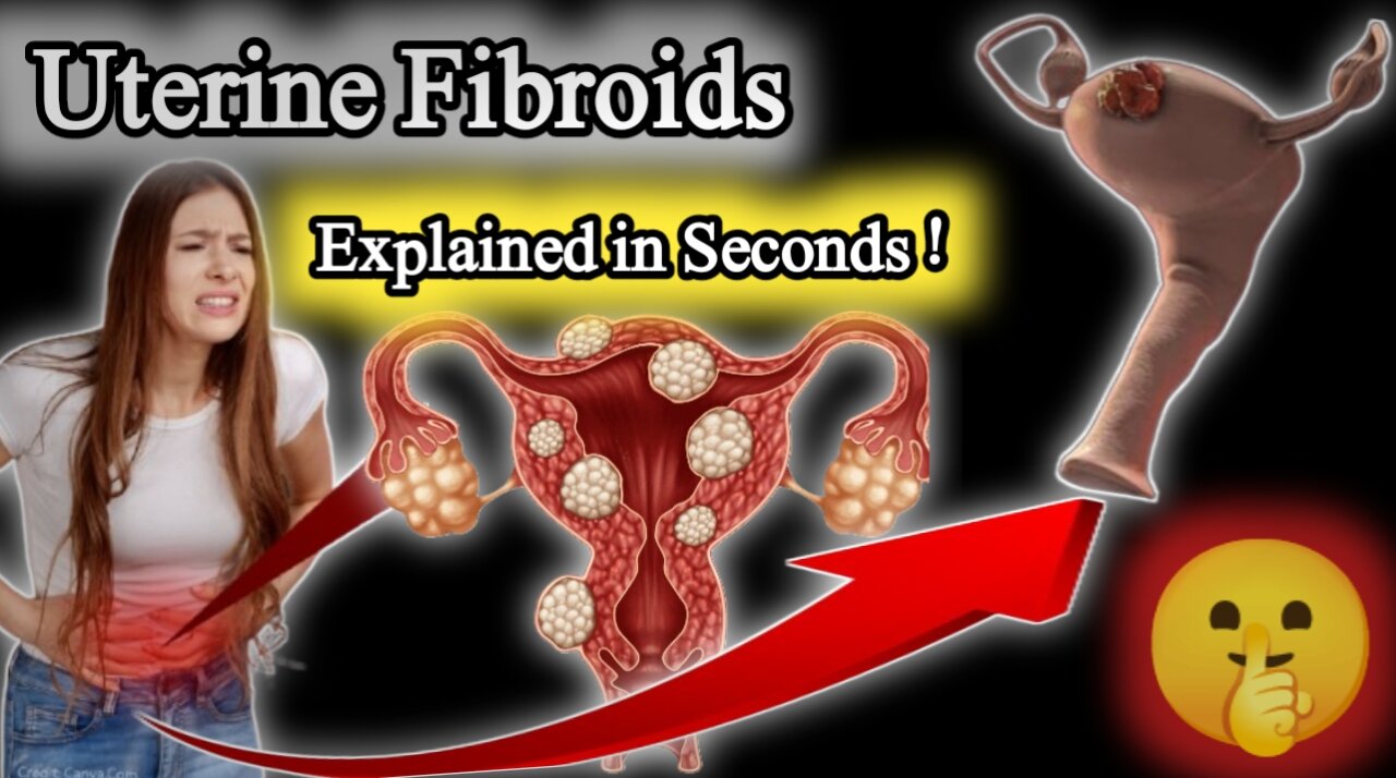 "Uterine Fibroids: Causes, Symptoms, and Treatment Explained!"