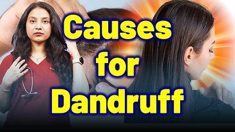 Causes for Dandruff, Seborrheic Dermatitis, Psoriasis| Treatment Cure Relief Medicine | Skin Hair |