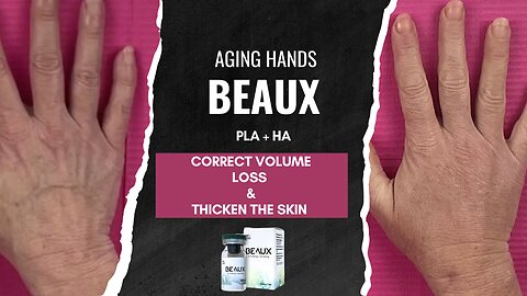 Beaux PLA + HA - Correct Aging Hands